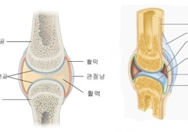 [일문일답 생활 속 건강] 무릎 물참