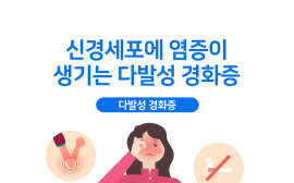 신경세포에 염증이 생기는 ‘다발성 경화증’