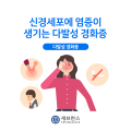 신경세포에 염증이 생기는 ‘다발성 경화증’