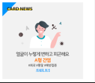 얼굴이 누렇게 변하는 A형 간염