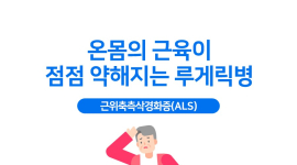 온몸 근육이 점점 약해지는 루게릭병